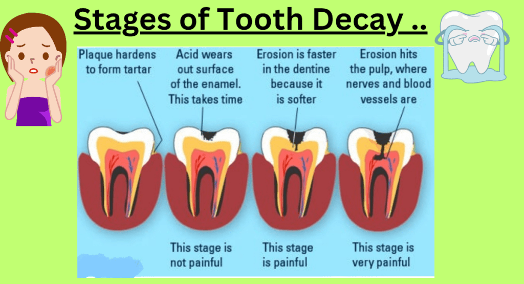 Tooth Decay And Blurred Vision